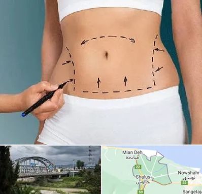 دکتر طب سنتی برای لاغری در چالوس
