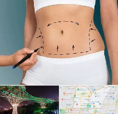 دکتر طب سنتی برای لاغری در منطقه 3 تهران 