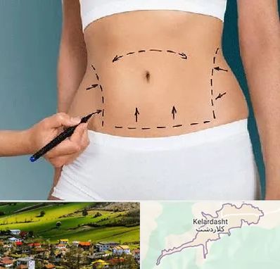 دکتر طب سنتی برای لاغری در کلاردشت