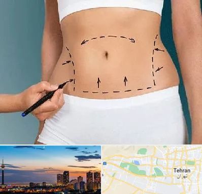 دکتر طب سنتی برای لاغری در غرب تهران 