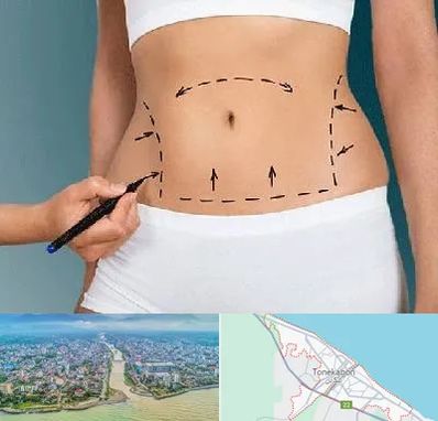 دکتر طب سنتی برای لاغری در تنکابن