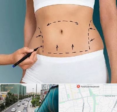 دکتر طب سنتی برای لاغری در بلوار فرحزادی
