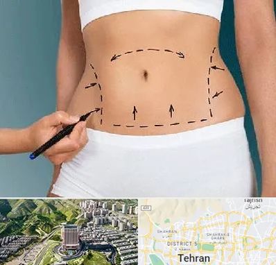 دکتر طب سنتی برای لاغری در شمال تهران 