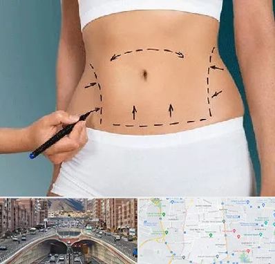 دکتر طب سنتی برای لاغری در منطقه 10 تهران 