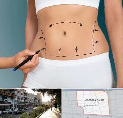 دکتر طب سنتی برای لاغری در خیابان جمالزاده