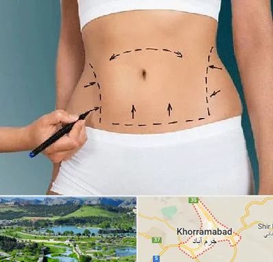 دکتر طب سنتی برای لاغری در خرم آباد