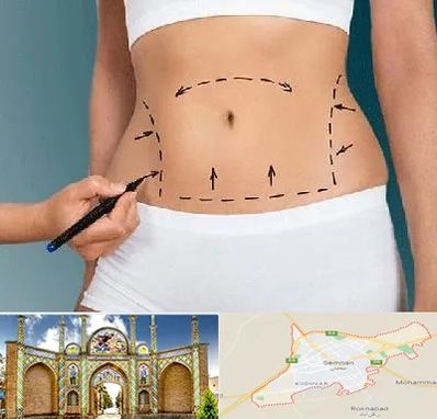 دکتر طب سنتی برای لاغری در سمنان