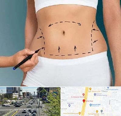 دکتر طب سنتی برای لاغری در ستاری 