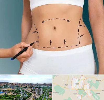 دکتر طب سنتی برای لاغری در شهریار