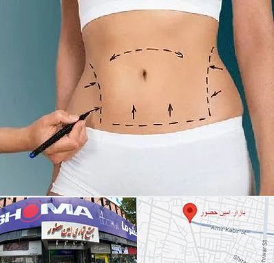 دکتر طب سنتی برای لاغری در امین حضور