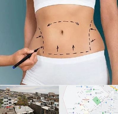 دکتر طب سنتی برای لاغری در شمیران نو 