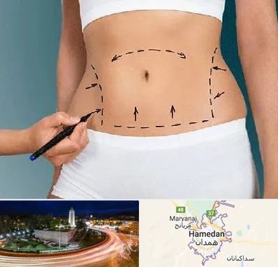 دکتر طب سنتی برای لاغری در همدان