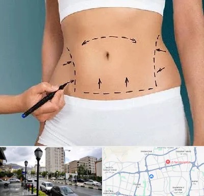 دکتر طب سنتی برای لاغری در شمال غرب تهران