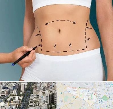 دکتر طب سنتی برای لاغری در منطقه 18 تهران