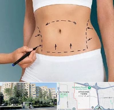 دکتر طب سنتی برای لاغری در آپادانا