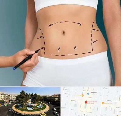 دکتر طب سنتی برای لاغری در هفت حوض 