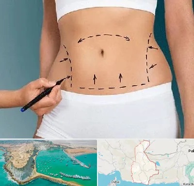 دکتر طب سنتی برای لاغری در سیستان و بلوچستان