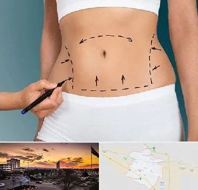 دکتر طب سنتی برای لاغری در قوچان