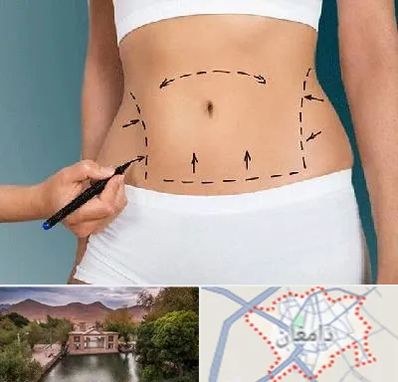 دکتر طب سنتی برای لاغری در دامغان