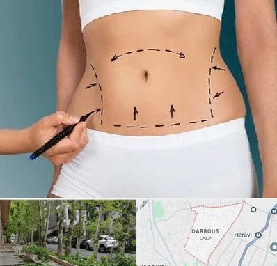 دکتر طب سنتی برای لاغری در دروس
