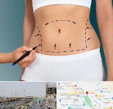 دکتر طب سنتی برای لاغری در بلوار توس مشهد 