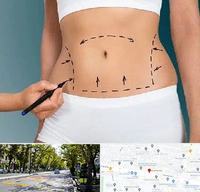 دکتر طب سنتی برای لاغری در میرداماد 