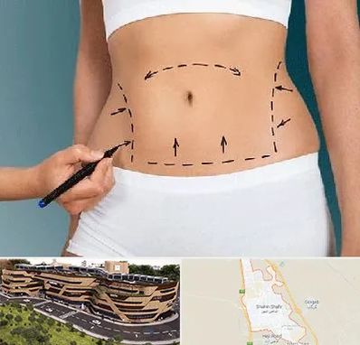 دکتر طب سنتی برای لاغری در شاهین شهر