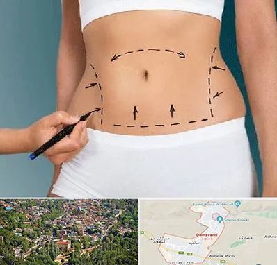 دکتر طب سنتی برای لاغری در دماوند