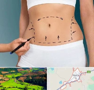 دکتر طب سنتی برای لاغری در نکا