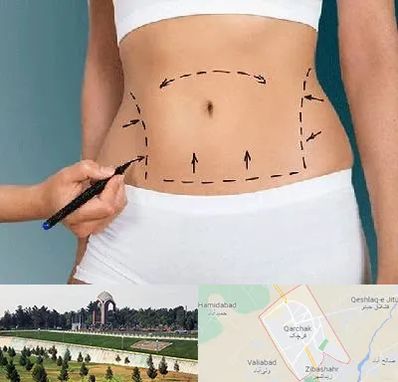 دکتر طب سنتی برای لاغری در قرچک