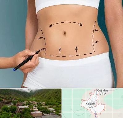 دکتر طب سنتی برای لاغری در کلاله