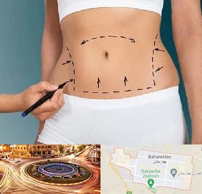 دکتر طب سنتی برای لاغری در بهارستان