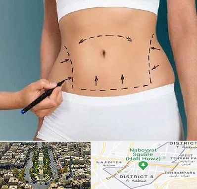 دکتر طب سنتی برای لاغری در نارمک 