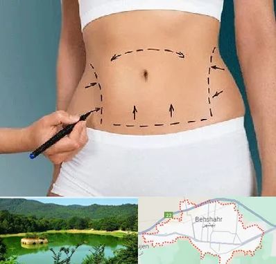 دکتر طب سنتی برای لاغری در بهشهر