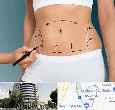 دکتر طب سنتی برای لاغری در قلهک 