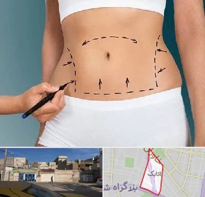 دکتر طب سنتی برای لاغری در اتابک