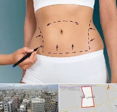 دکتر طب سنتی برای لاغری در شمس آباد تهران