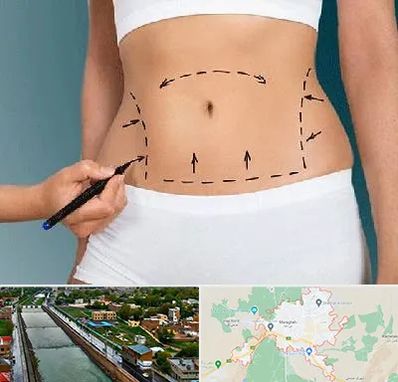 دکتر طب سنتی برای لاغری در مراغه