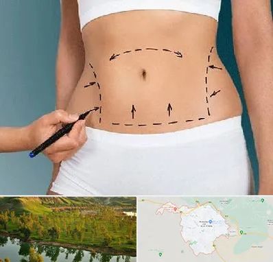 دکتر طب سنتی برای لاغری در بهبهان