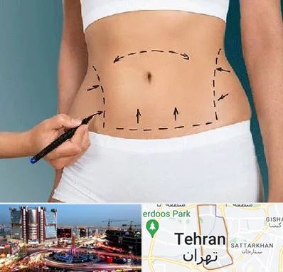 دکتر طب سنتی برای لاغری در صادقیه 