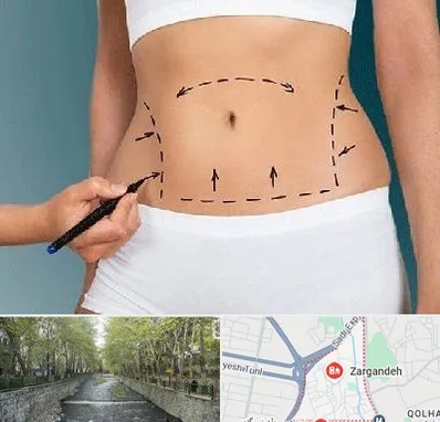 دکتر طب سنتی برای لاغری در زرگنده