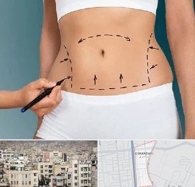 دکتر طب سنتی برای لاغری در اسکندری