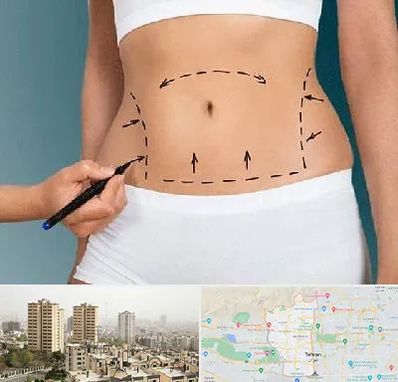 دکتر طب سنتی برای لاغری در منطقه 5 تهران 