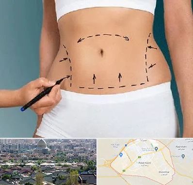 دکتر طب سنتی برای لاغری در رباط کریم