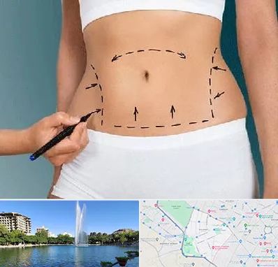 دکتر طب سنتی برای لاغری در کوهسنگی مشهد