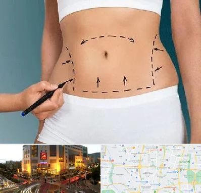 دکتر طب سنتی برای لاغری در جنت آباد تهران 