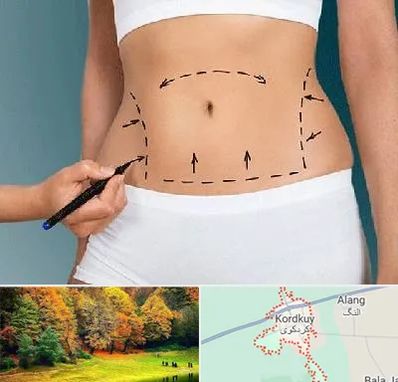 دکتر طب سنتی برای لاغری در کردکوی