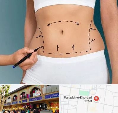 دکتر طب سنتی برای لاغری در 15 خرداد