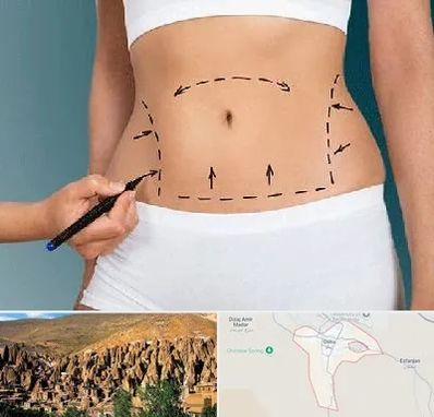 دکتر طب سنتی برای لاغری در اسکو