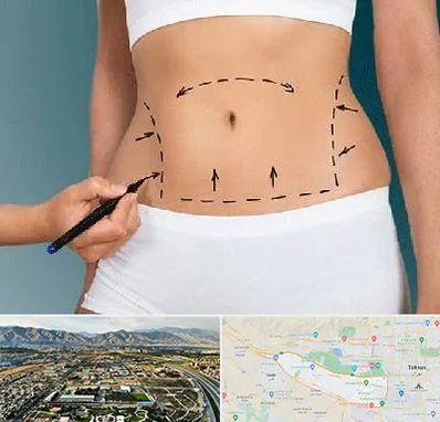 دکتر طب سنتی برای لاغری در منطقه 21 تهران 